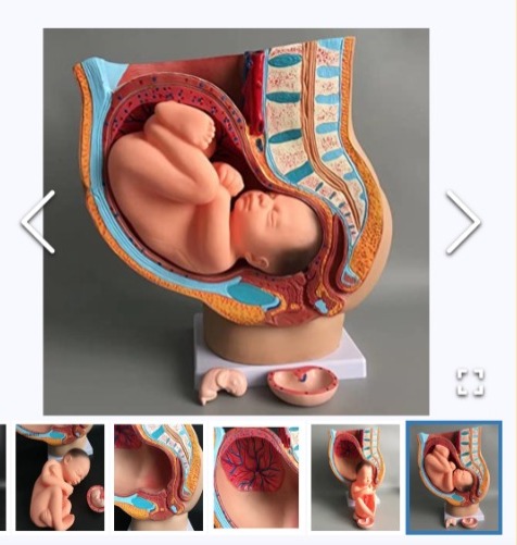 Esperando imagen del producto